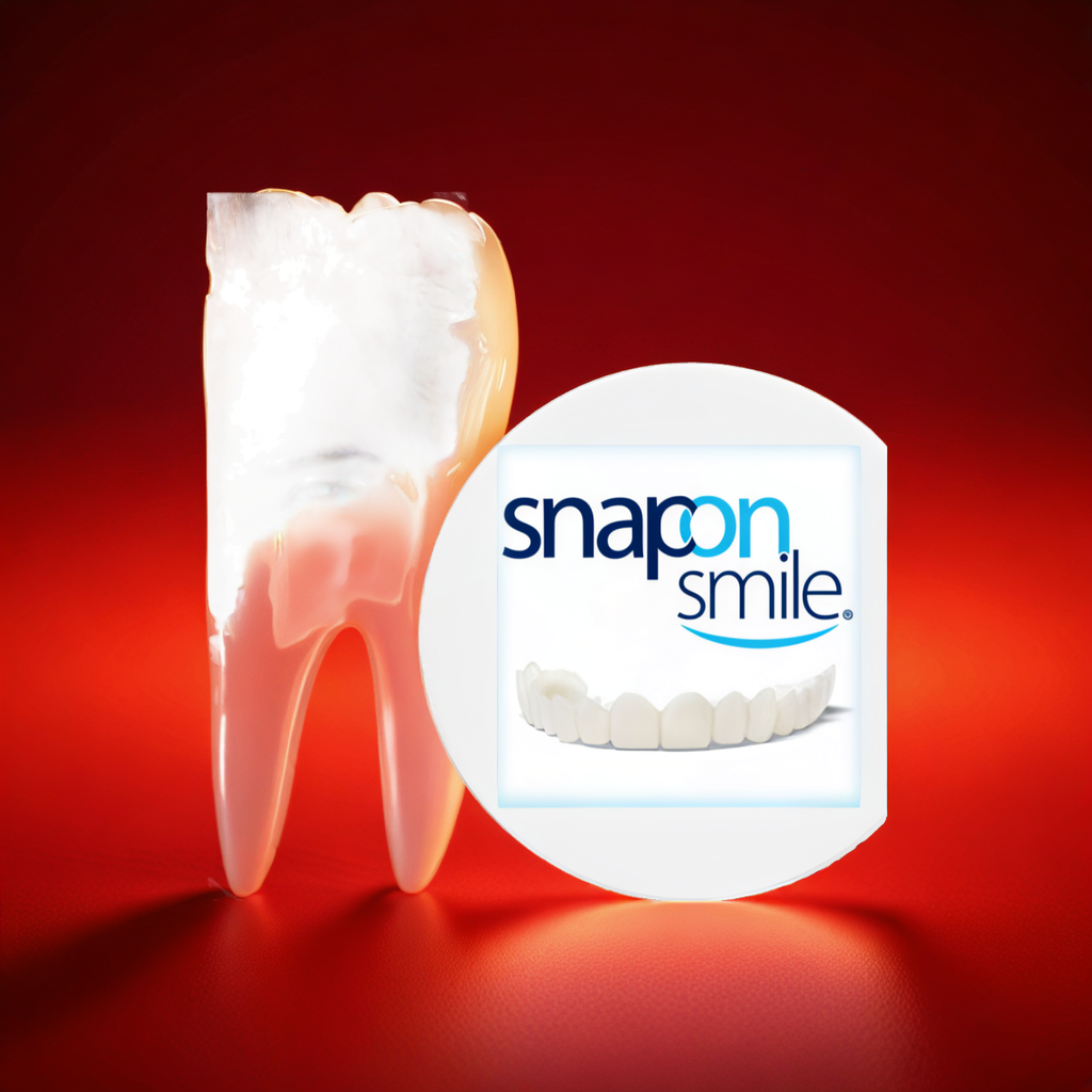 Snap-On Smile